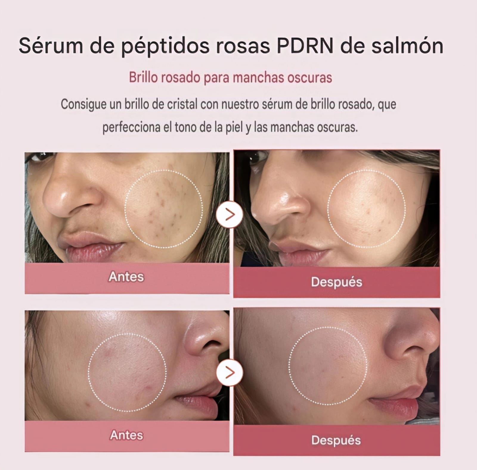 REGENIX | Coreano de salmón: Piel más firme, luminosa y rejuvenecida.